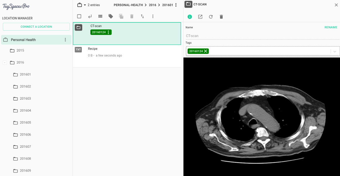 TagSpaces Prototype with Integrated DICOM Viewer